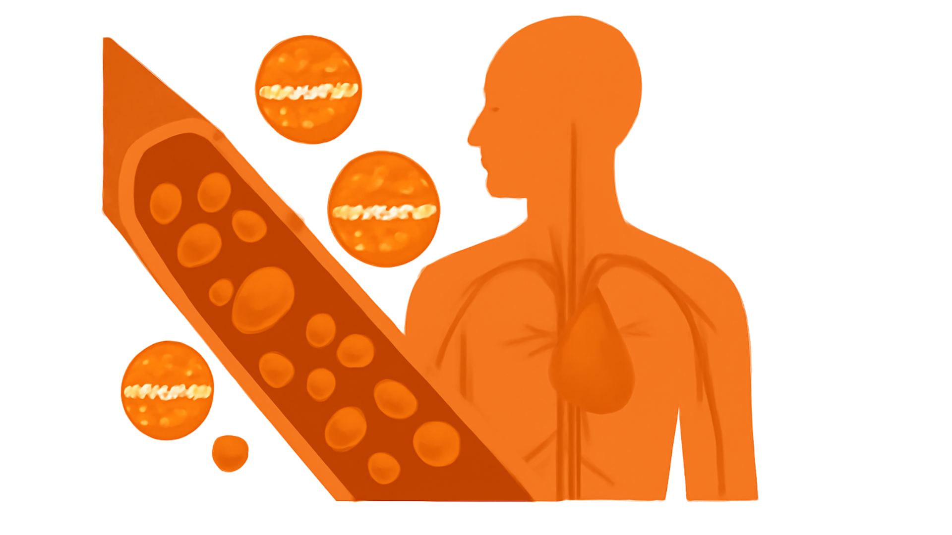 Icon for HYPERHOMOCYSTEINEMIA